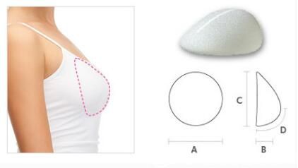 韓國RUBY如妃整形外科醫(yī)院水滴形胸 韓國RUBY如妃整形外科醫(yī)院水滴形胸