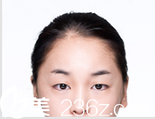 韓國DREAM夢想整形外科醫(yī)院案例 韓國DREAM夢想整形外科醫(yī)院案例