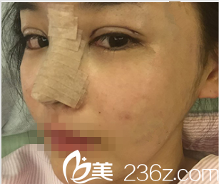 韓國DREAM夢想整形外科醫(yī)院案例 韓國DREAM夢想整形外科醫(yī)院案例