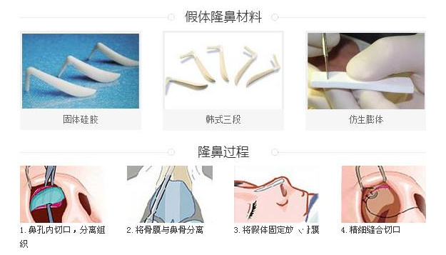 假體隆鼻材料及過程示意圖