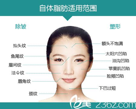 自體脂肪填充的范圍