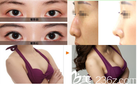 iFace整形外科部分案例