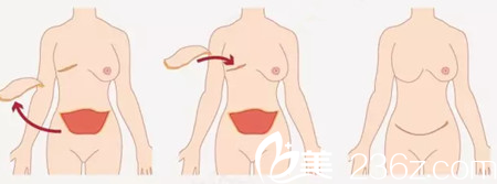 20171225_1514171691956988.png blob.png