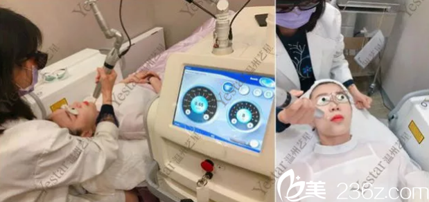 溫州藝星Yestar納秒鐳射祛斑過程