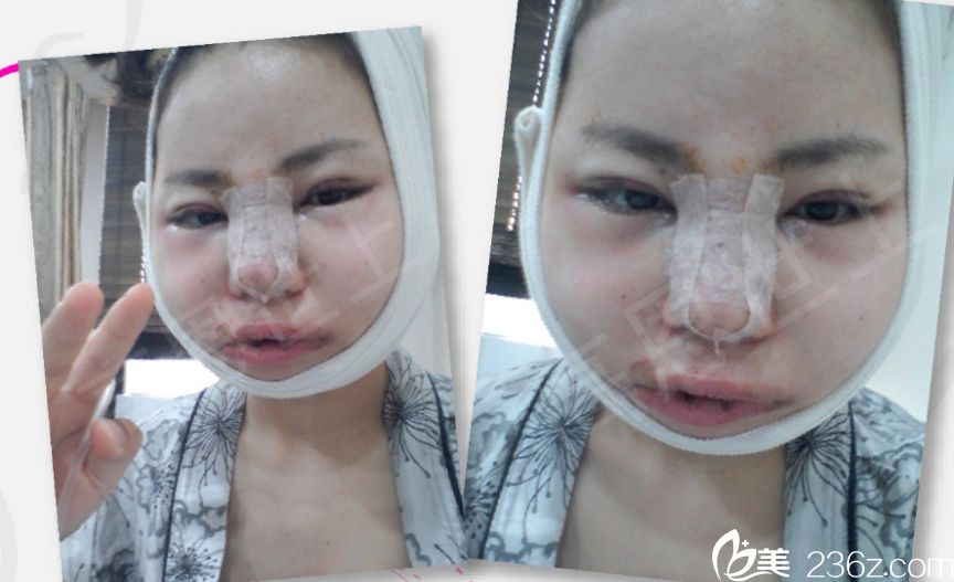 韓國高恩世上趙胄元面部輪廓真人<span style=