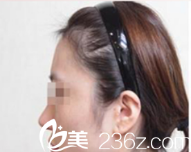 ISTAR整形外科案例 ISTAR整形外科案例