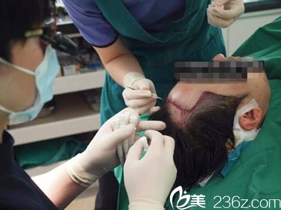 金大溶院長毛發(fā)移植手術(shù)過程