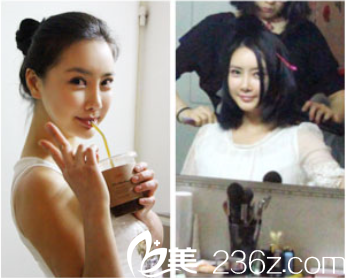 申承翰院長(zhǎng)面部輪廓案例術(shù)后效果