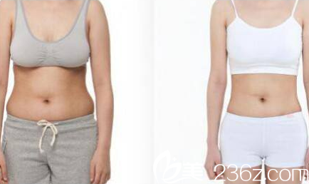 Beauty Line 4U整形外科醫(yī)院案例 Beauty Line 4U整形外科醫(yī)院案例