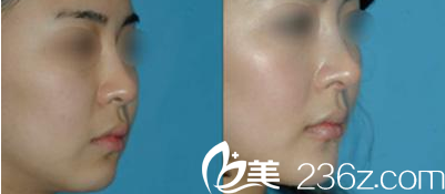 Beauty Line 4U整形外科醫(yī)院案例 Beauty Line 4U整形外科醫(yī)院案例