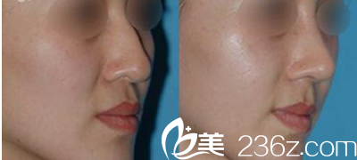 Beauty Line 4U整形外科醫(yī)院案例 Beauty Line 4U整形外科醫(yī)院案例