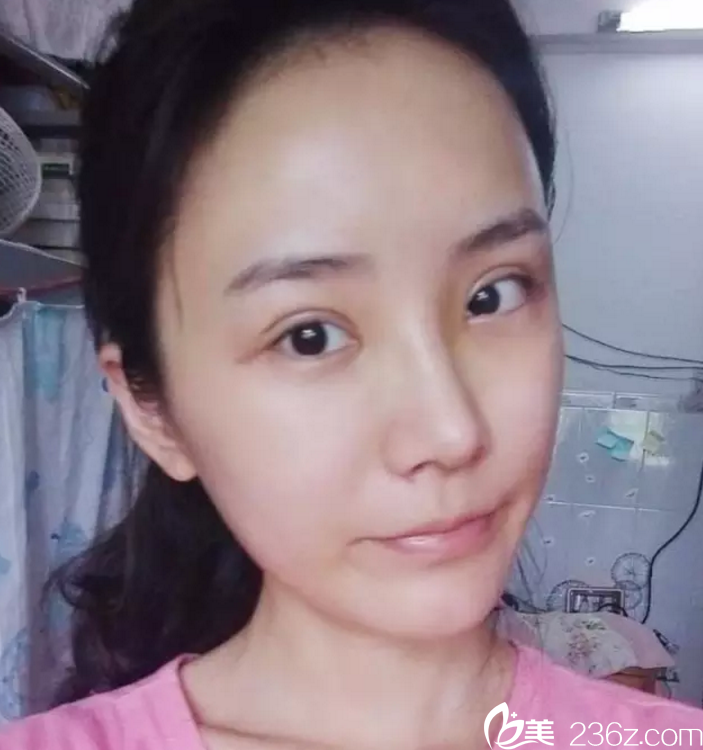 術(shù)后<span style=