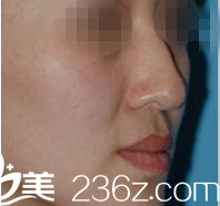 Beauty Line 4U整形外科醫(yī)院案例 Beauty Line 4U整形外科醫(yī)院案例