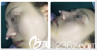 Beauty Line 4U整形外科醫(yī)院案例 Beauty Line 4U整形外科醫(yī)院案例