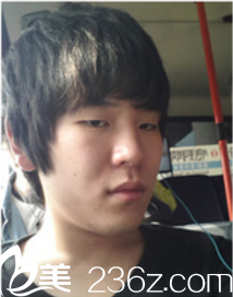 德萊茵TheLine整形外科真人整形案例術(shù)前 德萊茵TheLine整形外科真人整形案例術(shù)前