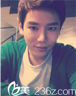 韓國(guó)德萊茵TheLine整形外科做雙眼皮怎么樣？鄭裕錫雙眼皮+鼻綜合真人案例