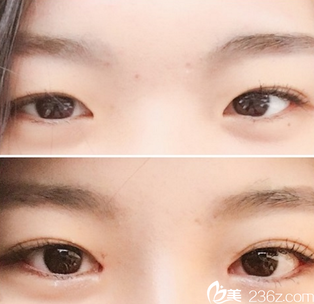 李柱洪院長案例