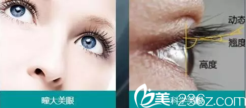 無痕翹睫重瞼術(shù)簡介 無痕翹睫重瞼術(shù)簡介