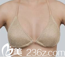 分享我在ELLIUM女性醫(yī)院做自體脂肪豐胸過(guò)程，樸烍暤院長(zhǎng)案例