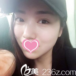 術(shù)后20天臉部整體變瘦