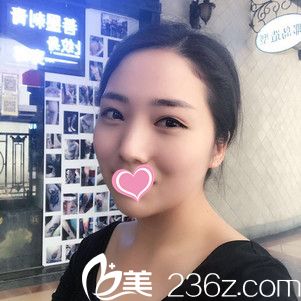 做完面部吸脂手術(shù)15天慢慢消腫中