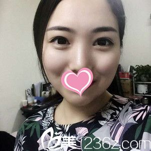 術(shù)后5天面部疼痛感消失