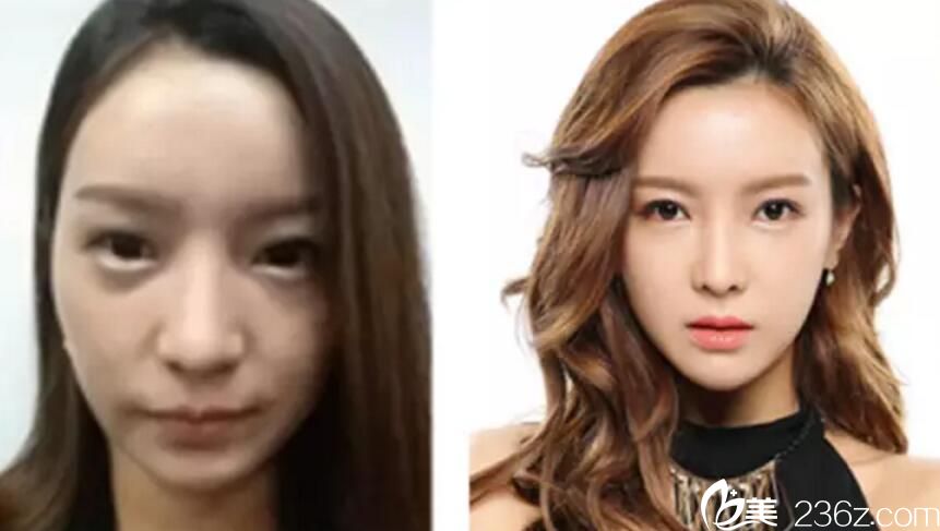 沈炯坤院長(zhǎng)打造的案例 沈炯坤院長(zhǎng)打造的案例