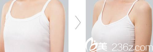 A特整形醫(yī)院案例 A特整形醫(yī)院案例