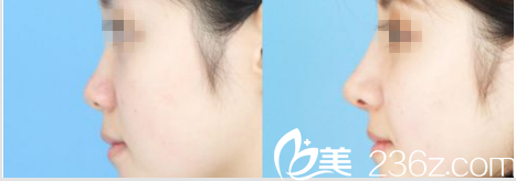 A特整形醫(yī)院案例 A特整形醫(yī)院案例