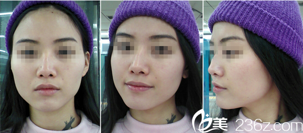 A特整形中心案例 A特整形中心案例