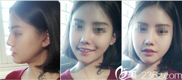 A特整形中心案例 A特整形中心案例