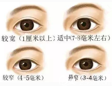 清潭雙眼皮寬度圖