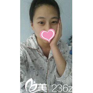 術(shù)前腫眼泡小眼睛 術(shù)前腫眼泡小眼睛