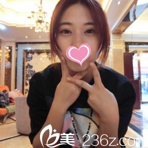 在邯鄲愛眼找張改秀院長做切開雙眼皮1個(gè)月后腫眼泡從此消失