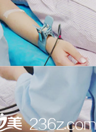 貴陽華美整形鼻綜合案例 貴陽華美整形鼻綜合案例