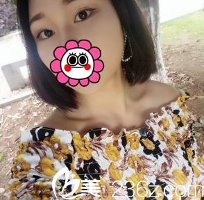 臨汾麗都金平雙眼皮3個(gè)月效果