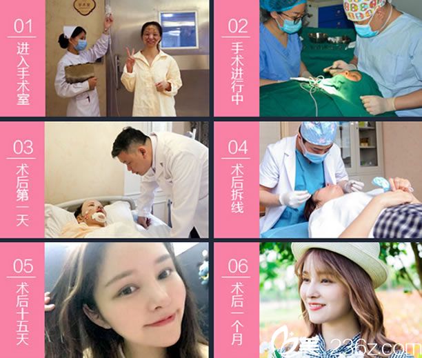 童桐在歐萊美的手術(shù)恢復過程圖 童桐在歐萊美的手術(shù)恢復過程圖