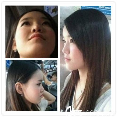 泉州歐菲王偉韜主任豐下巴前 泉州歐菲王偉韜主任豐下巴前