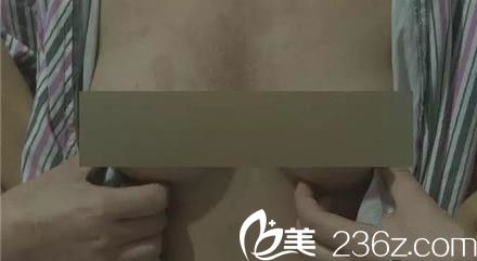 西安高一生醫(yī)療美容醫(yī)院術(shù)前 西安高一生醫(yī)療美容醫(yī)院術(shù)前