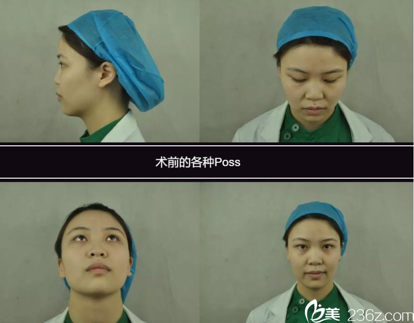 長沙亞韓醫(yī)學(xué)美容哪個醫(yī)生做鼻整形效果好 長沙亞韓醫(yī)學(xué)美容哪個醫(yī)生做鼻整形效果好