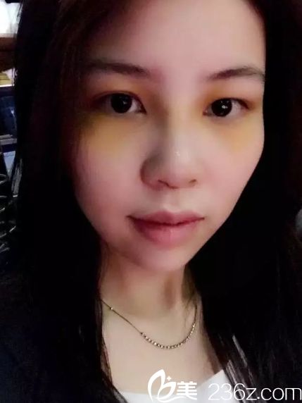 長沙亞韓醫(yī)學(xué)美容和長沙愛思特哪個醫(yī)院好 長沙亞韓醫(yī)學(xué)美容和長沙愛思特哪個醫(yī)院好