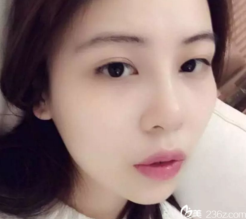 長(zhǎng)沙亞韓和愛思特哪個(gè)醫(yī)院做鼻子效果好