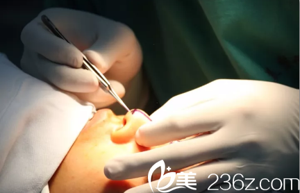 王文院長開始對鼻部進(jìn)行設(shè)計