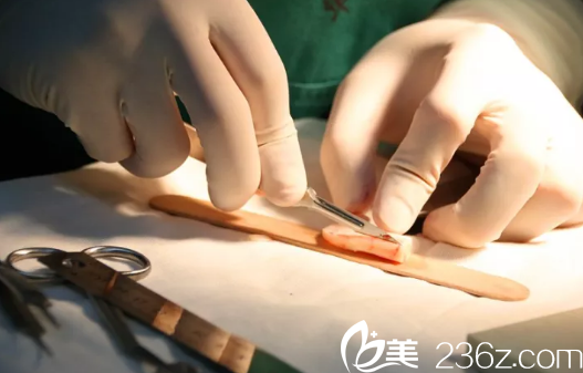 肋軟骨鼻尖雕刻