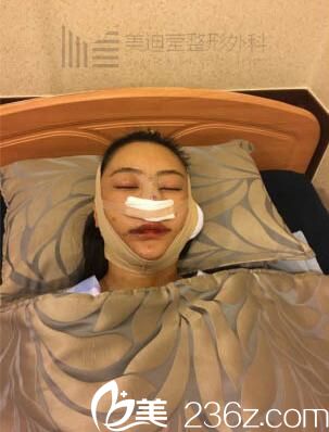 韓國美迪瑩整形真人案例2