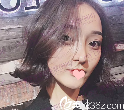 找四川美萊韓國棟做完鼻修復(fù)4個月 找四川美萊韓國棟做完鼻修復(fù)4個月