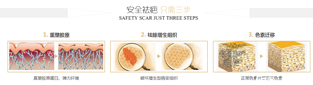 黃志勇醫(yī)生祛疤原理