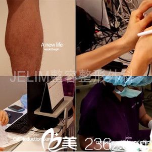 JELIM整形外科小腿醫(yī)生李仁嬅