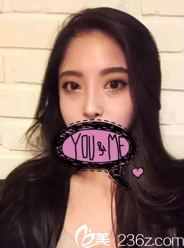 術后兩個月左右