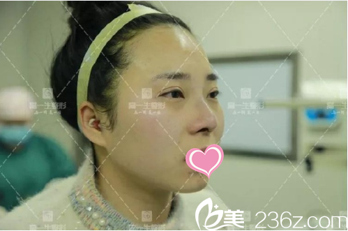 恢復(fù)一周后在樣子